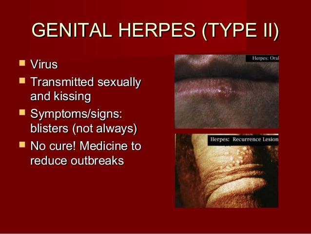 How to reduce a big pimple overnight Signs Of Sexual Disease